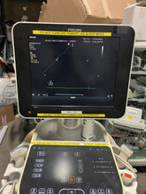 Philips Sparq Ultrasound