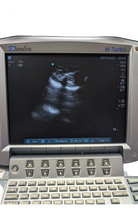 Sonosite M-Turbo Ultrasound